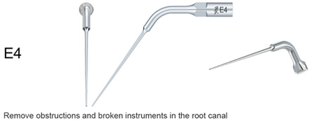 Woodpecker®UDSシリーズ根管治療用チップE4（EMSと交換、5本入）